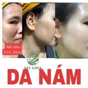 eva diamond Quảng nam